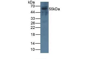 Detection of CFI in Porcine Kidney Tissue using Polyclonal Antibody to Complement Factor I (CFI) (Complement Factor I antibody  (AA 28-243))