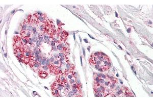 Detection of PDPN in Human Breast Tissue using Polyclonal Antibody to Podoplanin (PDPN) (Podoplanin antibody  (AA 23-143))