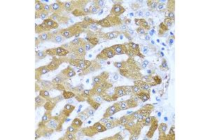 Immunohistochemistry of paraffin-embedded human liver using IFIT3 antibody (ABIN1680389, ABIN3018293, ABIN3018295 and ABIN6220427) at dilution of 1:100 (40x lens). (IFIT3 antibody  (AA 128-331))