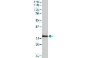 VAPB MaxPab polyclonal antibody. (VAPB antibody  (AA 1-243))