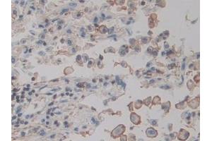 ACTG2 antibody  (AA 3-376)