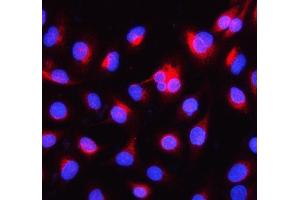 IF analysis of Alpha Internexin using anti-Alpha Internexin antibody (ABIN4886634). (INA antibody  (AA 71-161))