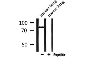 Western blot analysis of extracts from mouse lung, using MLH1 Antibody.