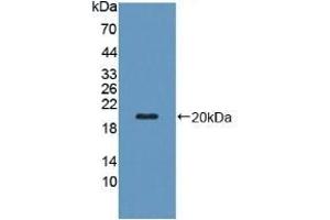 Detection of Recombinant PZP, Human using Polyclonal Antibody to Pregnancy Zone Protein (PZP)