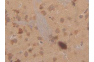 Detection of CK18 in Mouse Cerebrum Tissue using Polyclonal Antibody to Cytokeratin 18 (CK18) (Cytokeratin 18 antibody  (AA 1-423))