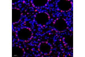 Immunofluorescence (Paraffin-embedded Sections) (IF (p)) image for anti-Transketolase (TKT) antibody (ABIN7075978)