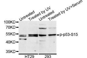 Western blot analysis of extracts of HT-29 cell line, using Phospho-p53-S15 antibody. (p53 antibody  (pSer15))