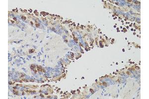 Immunohistochemistry of paraffin-embedded mouse bronchial epithelium using PDCD1 antibody (ABIN6290170) at dilution of 1:200 (40x lens). (PD-1 antibody)