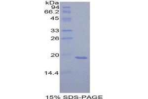 SDS-PAGE (SDS) image for Lymphotoxin-alpha (LTA) (AA 49-202) protein (His tag) (ABIN2122282)