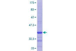 RPL10L Protein (AA 115-214) (GST tag)