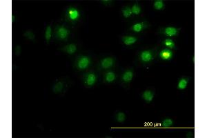 Immunofluorescence of monoclonal antibody to CSE1L on HeLa cell. (Exportin 2 antibody  (AA 872-971))