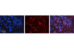 Rabbit Anti-PRKCD Antibody Catalog Number: ARP56701_P050 Formalin Fixed Paraffin Embedded Tissue: Human Lymph Node Tissue Observed Staining: Cytoplasm Primary Antibody Concentration: 1:600 Other Working Concentrations: N/A Secondary Antibody: Donkey anti-Rabbit-Cy3 Secondary Antibody Concentration: 1:200 Magnification: 20X Exposure Time: 0. (PKC delta antibody  (N-Term))