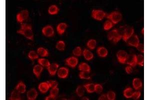ABIN6274947 staining HuvEc by IF/ICC. (CLIP1 antibody  (C-Term))