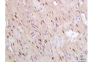 Formalin-fixed and paraffin embedded rat heart labeled with Anti Glucagon Receptor Polyclonal Antibody, Unconjugated (ABIN751528) followed by conjugation to the secondary antibody and DAB staining