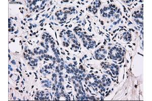 Immunohistochemical staining of paraffin-embedded breast tissue using anti-ID3 mouse monoclonal antibody. (ID3 antibody)