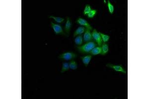 Immunofluorescence staining of HepG2 cells with ABIN7143311 at 1:133, counter-stained with DAPI. (AHCY antibody  (AA 2-432))