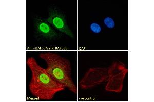 (ABIN185217) Immunofluorescence analysis of paraformaldehyde fixed U2OS cells, permeabilized with 0. (BAF53A and BAF53B (C-Term) antibody)