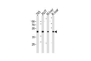 Western blot analysis in 293,293T cell line ,mouse liver and rat liver tissue lysates (35ug/lane). (OAT antibody  (N-Term))