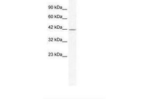 Image no. 1 for anti-gamma-aminobutyric Acid (GABA) A Receptor, alpha 3 (GABRA3) (AA 217-266) antibody (ABIN202653) (GABRA3 antibody  (AA 217-266))