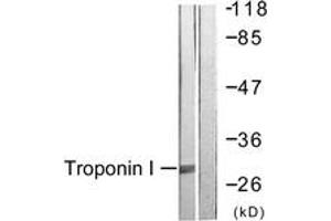 Western Blotting (WB) image for anti-Cardiac Troponin I (TNNI3) (AA 11-60) antibody (ABIN2888778) (TNNI3 antibody  (AA 11-60))