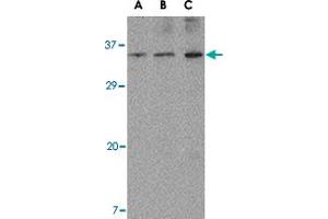 Western blot analysis of ORAI3 in A-20 cell lysate with ORAI3 polyclonal antibody  at (A) 1, (B) 2 and (C) 4 ug/mL . (ORAI3 antibody  (N-Term))