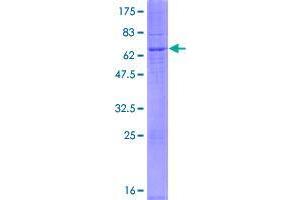 DEGS2 Protein (AA 1-323) (GST tag)