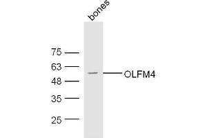 Mouse bone lysates probed with Rabbit Anti- Polyclonal Antibody, Unconjugated  at 1:500 for 90 min at 37˚C. (Olfactomedin 4 antibody  (AA 111-510))