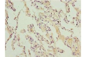 Immunohistochemistry of paraffin-embedded human lung tissue using ABIN7150982 at dilution of 1:100