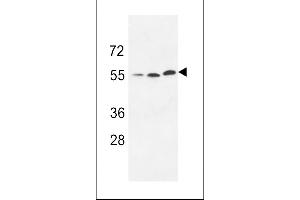 Western blot analysis of anti-URKL1 Pabin 293 cell line lysate (35ug/lane). (UCKL1 antibody  (N-Term))