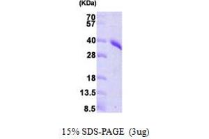PRPS1 Protein (AA 1-318) (His tag)