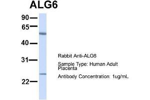 Host:  Rabbit  Target Name:  ALG6  Sample Type:  Human Adult Placenta  Antibody Dilution:  1. (ALG6 antibody  (N-Term))