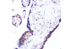 Immunohistochemistry of paraffin-embedded human placenta using RRAGA Rabbit pAb (ABIN7269878) at dilution of 1:100 (40x lens). (RRAGA antibody  (AA 1-160))