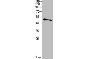 Western blot analysis of HELA-UV Cell Lysate using antibody (MDM2 antibody  (pTyr394))