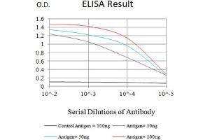Black line: Control Antigen (100 ng),Purple line: Antigen (10 ng), Blue line: Antigen (50 ng), Red line:Antigen (100 ng) (Progesterone Receptor antibody  (AA 166-411))