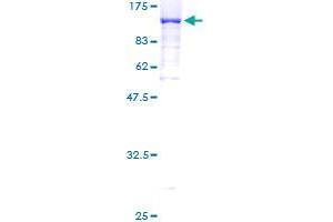 Image no. 1 for Dynein, Axonemal, Intermediate Chain 1 (DNAI1) (AA 1-699) protein (GST tag) (ABIN1351746)