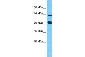 Host: Rabbit Target Name: FAM193A Sample Type: 293T Whole Cell lysates Antibody Dilution: 1. (FAM193A antibody  (C-Term))