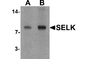 Western blot analysis of SELK in A20 cell lysate with SELK antibody at (A) 1 and (B) 2 µg/mL. (Selenoprotein K antibody  (C-Term))