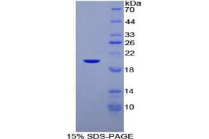 SDS-PAGE analysis of Human C/EBP gamma Protein. (CEBPG Protein)
