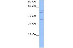 CCDC78 antibody used at 1 ug/ml to detect target protein. (CCDC78 antibody  (Middle Region))
