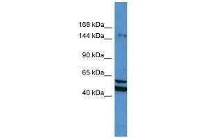 WB Suggested Anti-ZMYM3 Antibody Titration: 0. (ZMYM3 antibody  (N-Term))