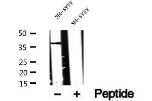 Western blot analysis of extracts of SH-SY5Y cells, using CXXC5 antibody. (CXXC5 antibody)