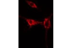 ABIN6275467 staining  HuvEc cells by IF/ICC. (RAB37 antibody  (C-Term))