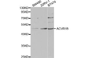 Western blot analysis of extracts of various cell lines, using ACVR1B antibody. (Activin A Receptor Type IB/ALK-4 antibody)