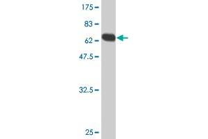 Western Blotting (WB) image for anti-Diphthamide Biosynthesis Protein 2 (DPH2) (AA 1-489) antibody (ABIN515061)