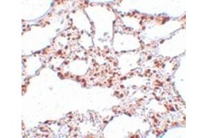 Immunohistochemical staining of rat lung tissue with ZSCAN4 polyclonal antibody  at 5 ug/mL dilution. (ZSCAN4 antibody  (C-Term))