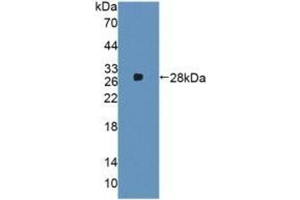 alpha 2 Macroglobulin antibody  (AA 616-856)