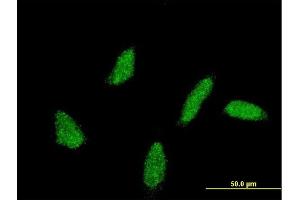 Immunofluorescence of monoclonal antibody to UBE2U on HeLa cell. (UBE2U antibody  (AA 9-102))