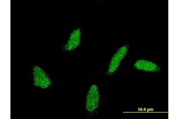 UBE2U antibody  (AA 9-102)