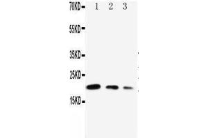Anti-CDC42 antibody, Western blotting Lane 1: Recombinant Human CDC42 Protein 10ng Lane 2: Recombinant Human CDC42 Protein 5ng Lane 3: Recombinant Human CDC42 Protein 2.