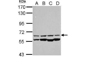 WB Image Sample (30 ug of whole cell lysate) A: NT2D1 B: PC-3 C: U87-MG D: SK-N-SH 7. (CCT8L2 antibody  (C-Term))